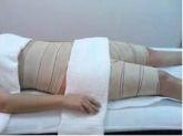Crioterapia 10 sessões